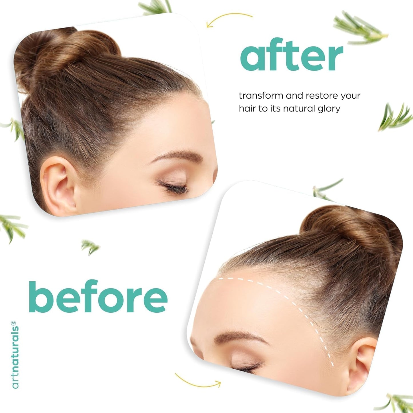 Rosemary Castor Hair Oil + Massager Hair Growth Set