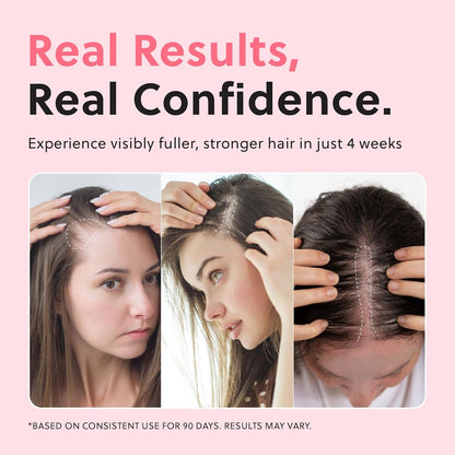 Hair Growth Serum for Women