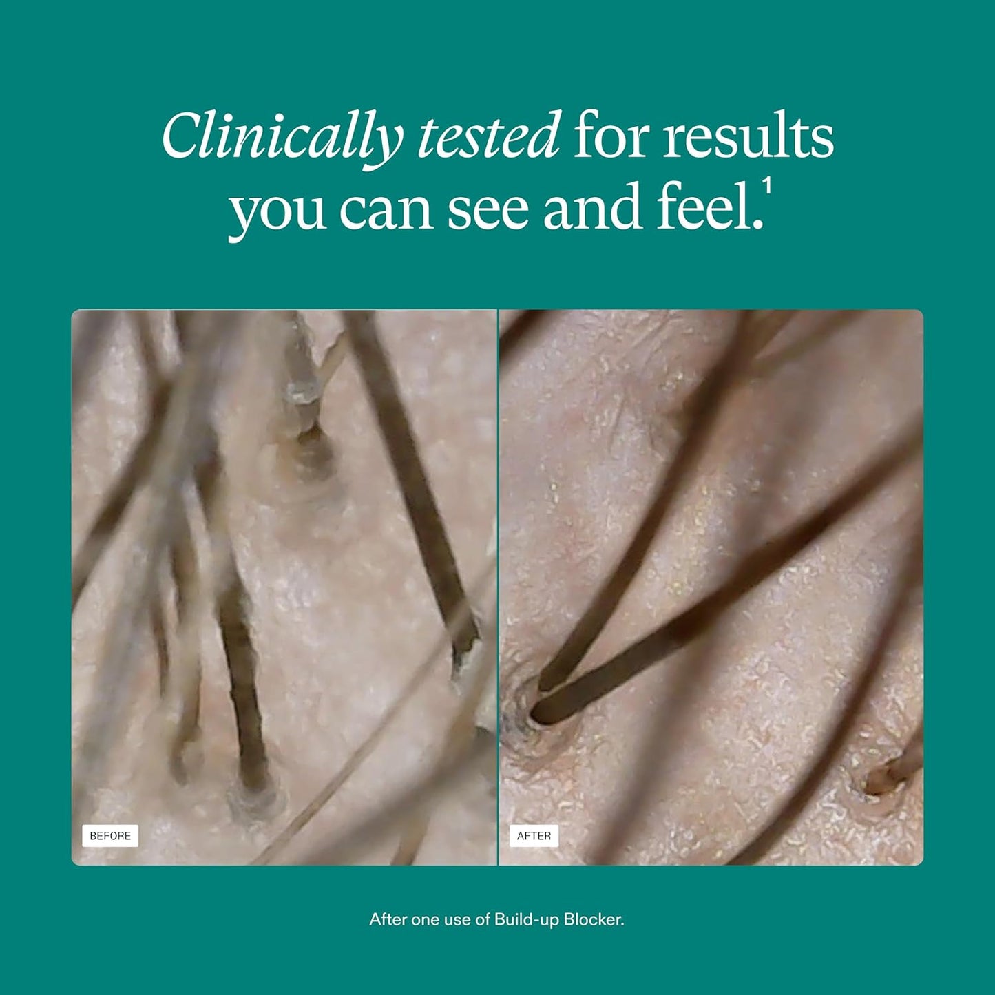 Nutrafol Exfoliating Scalp Mask