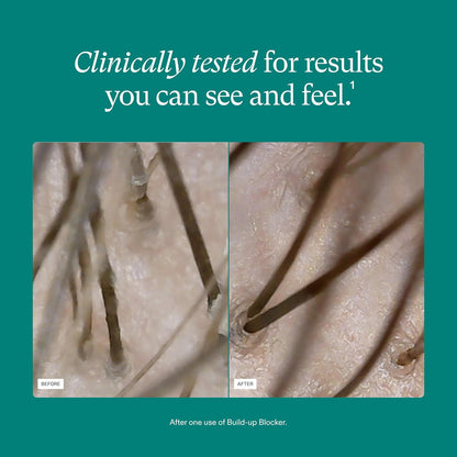 Nutrafol Exfoliating Scalp Mask