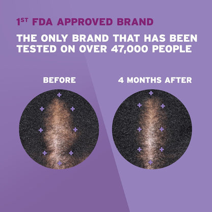 Rogaine 5% Minoxidil Foam